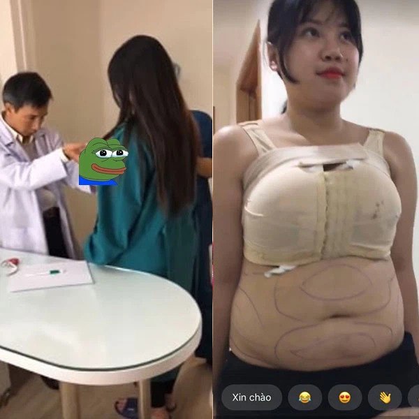 Hotgirl Hai Duong tries to fix it: 3 liters of breast fat is still not slim, the nose is misaligned for the second time - 5