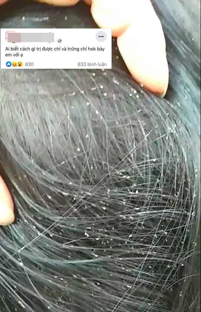 Shivering how mothers treat hair lice for their children: straightening, straightening and straightening, special treatment with... washing powder - 1