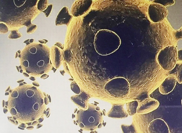 Hình ảnh do Cơ quan dược phẩm và thực phẩm Mỹ cung cấp về virus SARS-CoV-2 gây dịch viêm đường hô hấp cấp COVID-19.