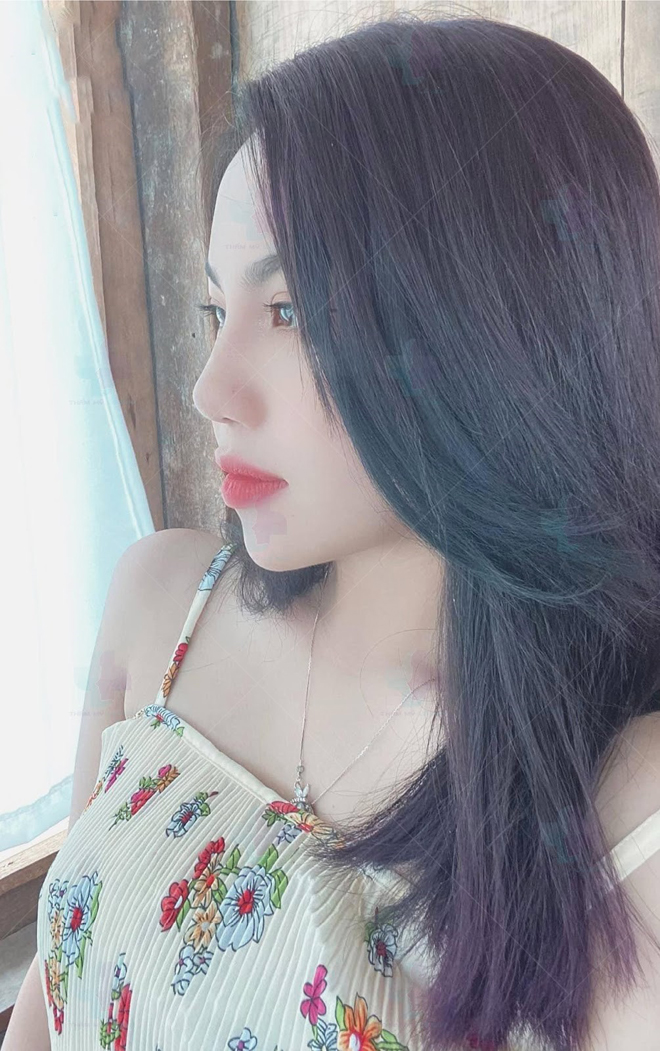 Các phương pháp nâng mũi amp;#34;để đờiamp;#34; của bác sĩ Lê Quý  - 3