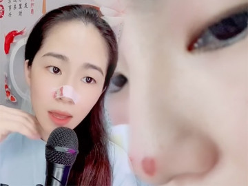 Lương Bích Hữu bị nói sửa mũi hư, nữ ca sĩ tiết lộ nguyên nhân ai cũng nể