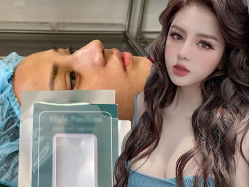 6 câu hỏi thường gặp khi nâng mũi bạn cần biết: 95% mũi sau nâng sẽ có dáng chuẩn nhất