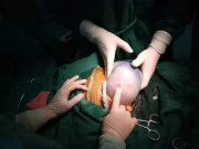 Bà bầu - Đứng cạnh xem vợ đẻ, chồng tái mét mặt khi thấy bác sĩ lấy ra "cục thịt"