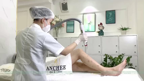 Trị sẹo thâm ở chân lâu năm bằng Laser + Tảo tại Bống Spa amp; Clinic  - 2