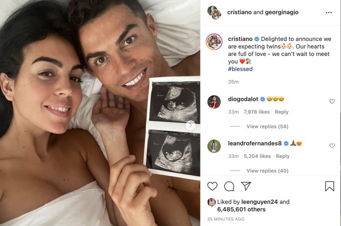 Cristiano Ronaldo xót xa báo tin con trai qua đời, chỉ còn lại một bé gái - 1