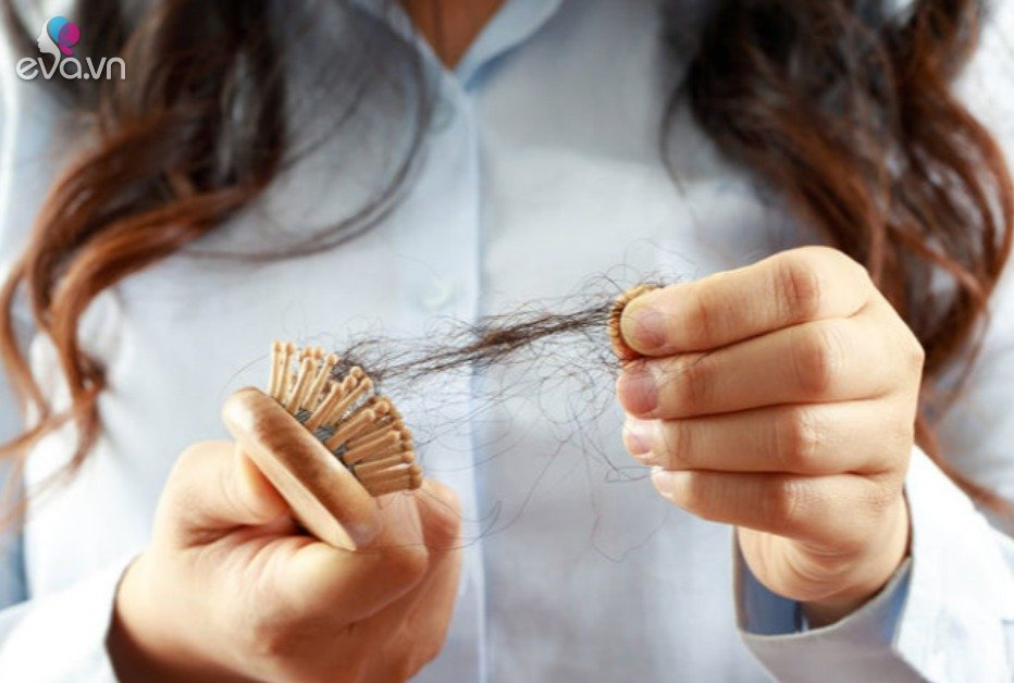 No matter how much money you spend on care, your hair will still fall out if your body lacks this substance, women keep in shape or get sick