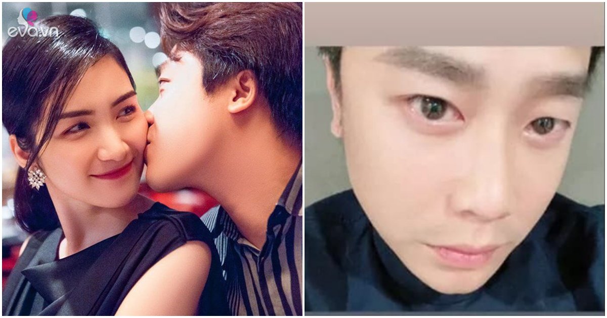 After 2 months of breaking up, Hoa Minzy’s ex-boyfriend revealed puffy, tearful eyes