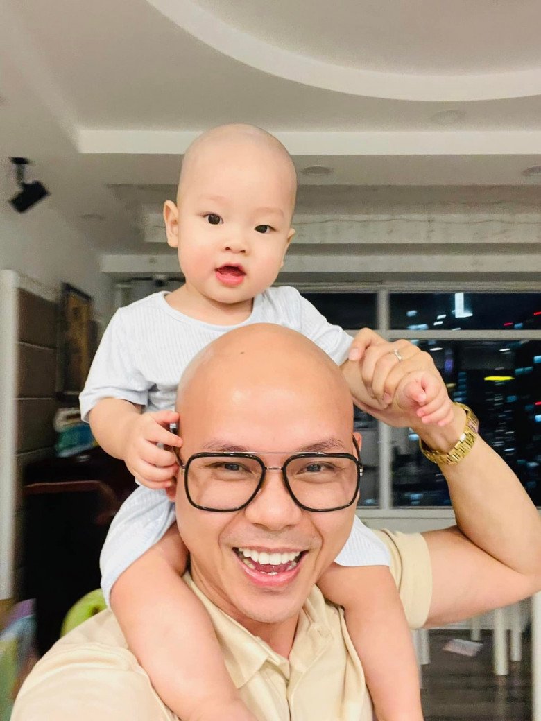 Phan Dinh Tung has a hair disease that does not grow, everyone who meets 2 children caresses his hair - 13