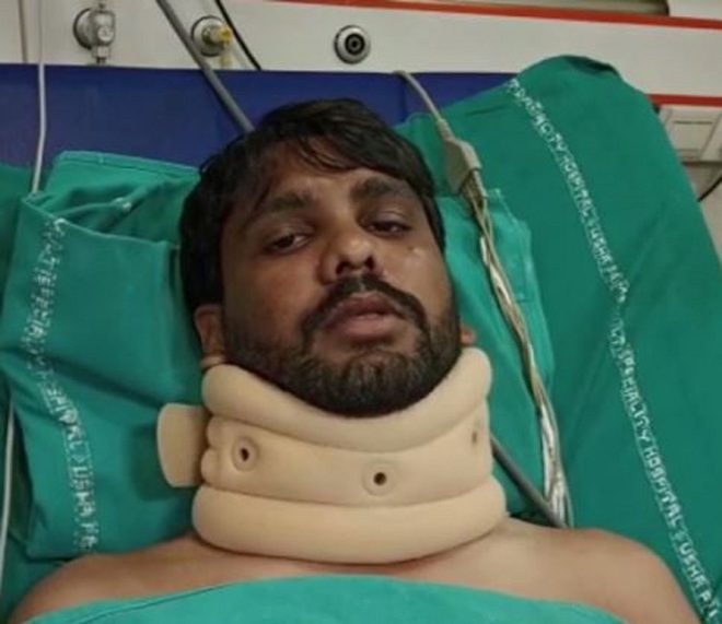 Nạn nhân Addepalli Ram Naidu.