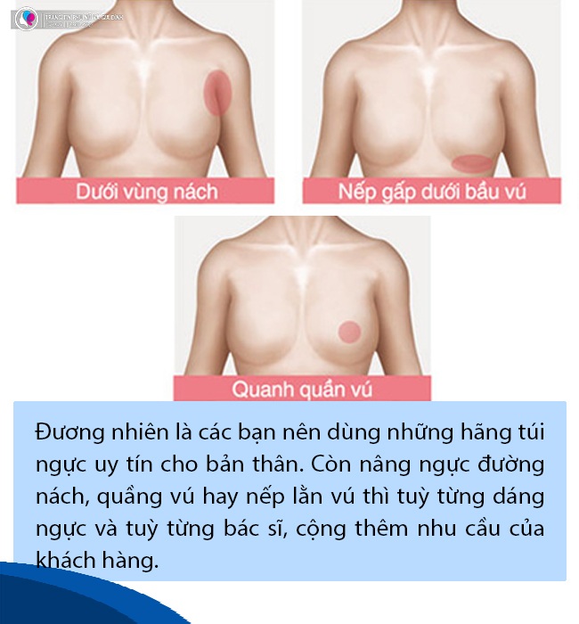 TS.BS Nguyen Huu Quang: The case of anaphylaxis when breast augmentation is force majeure - 8