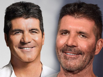 Simon Cowell tiêm botox nhiều đến mức khiến con trai 8 tuổi "khóc thét"