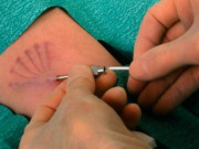 Bà bầu - 25 phụ nữ cấy que tránh thai về "dính" bầu, phát hiện sự thật "động trời" về nam bác sĩ