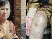 Tin tức - Người phụ nữ sống sót sau 7 ngày rơi xuống vực: Không bịa chuyện để "câu like"