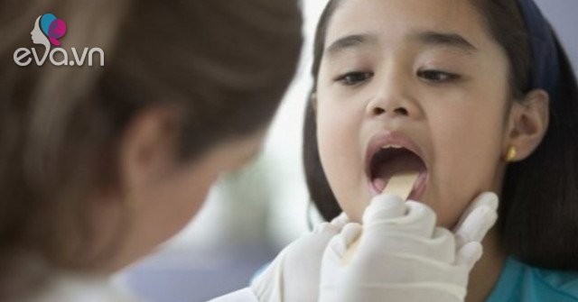 Children with tonsillitis should be treated like?