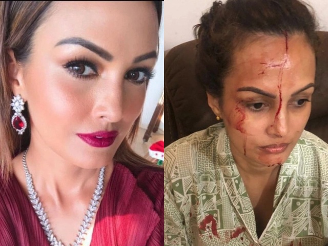 Ngôi sao 24/7: Mỹ nhân Ấn Độ tố cáo bị chồng cũ đánh đến mức không ngửi được mùi