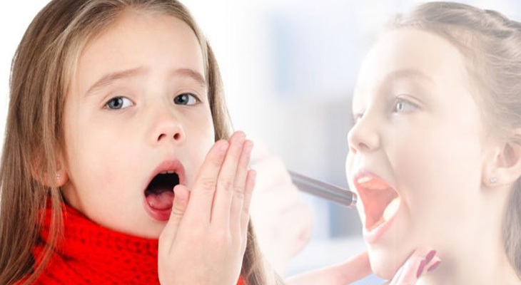 Children with tonsillitis should be treated like?  - 4