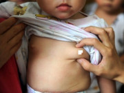 Sức khỏe - Bé gái Sài Gòn 16 tháng tuổi đã dậy thì, nguyên nhân bất ngờ đến từ người mẹ khiến ai cũng choáng váng