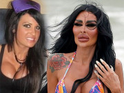 Làm đẹp - Chi gần 5 tỷ phẫu thuật thẩm mỹ, nữ người mẫu bị chê thảm họa dao kéo