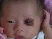 Bà bầu - Con chào đời nhìn như "gấu trúc", mẹ ôm đầu hối hận khi bác sĩ nói nguyên nhân