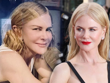Nicole Kidman làm gì trên gương mặt không nếp nhăn ở tuổi U60?