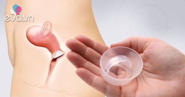Advantages and disadvantages of 10 current methods of contraception you should know