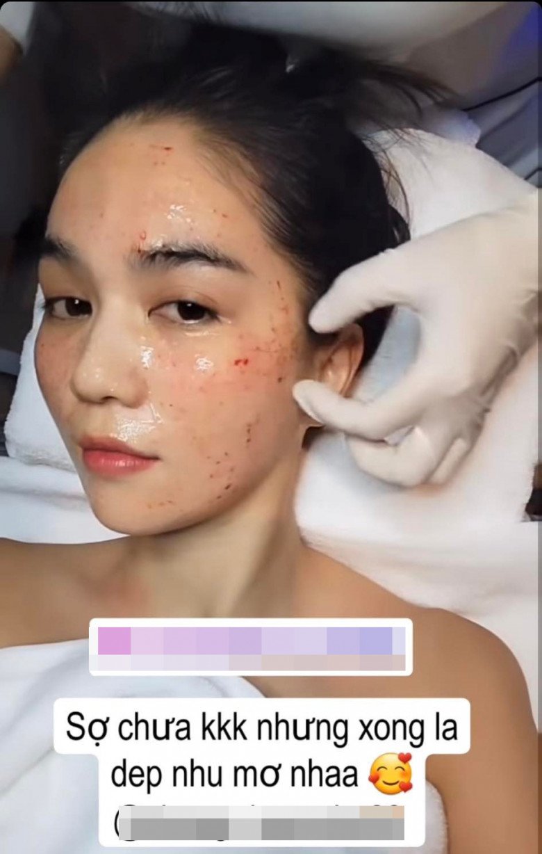 Ngoc Trinh promotes anti-aging as... a vampire, her face is bloody but confident and beautiful - 4