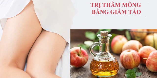 Những cách trị thâm mông an toàn hiệu quả nhanh nhất tại nhà - 14