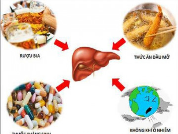 7 thói quen bào mòn lá gan từng ngày, cứ kéo dài chẳng mấy mà ung thư gan