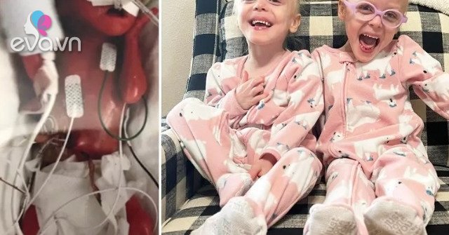 The twins were born at 22 weeks and the intense life journey surprised everyone