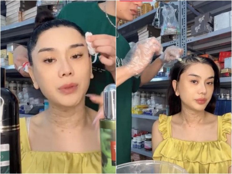 Spending hundreds of millions of beauty treatments every year, Lam Khanh Chi still constantly shows signs of aging, thick mask #34;  hard to save - 5