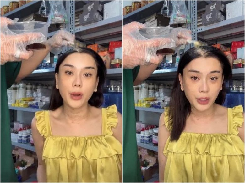 Spending hundreds of millions of beauty treatments every year, Lam Khanh Chi still constantly shows signs of aging, thick mask #34;  hard to save - 6