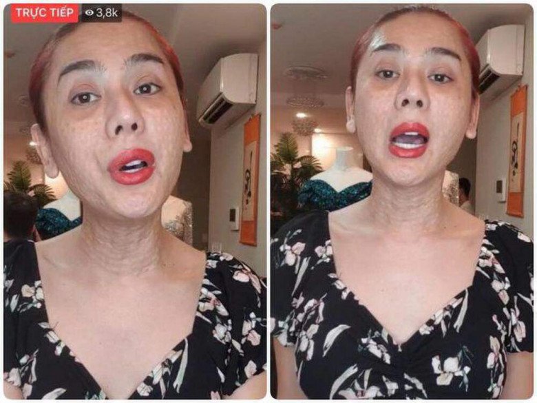 Spending hundreds of millions of beauty treatments every year, Lam Khanh Chi still constantly shows signs of aging, thick mask #34;  hard to save - 10