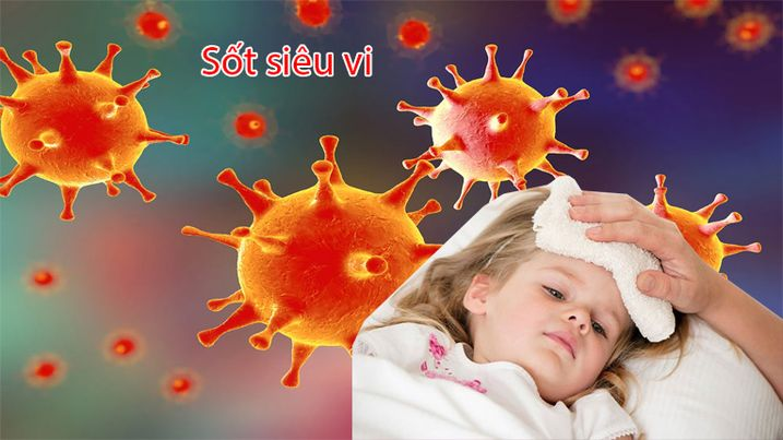 Sốt siêu vi và sốt xuất huyết ở trẻ khác nhau như thế nào - 5