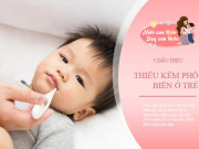 Làm mẹ - Trẻ thiếu chất này đề kháng và trí tuệ giảm sút, 6 dấu hiệu nhận biết mẹ không thể bỏ qua