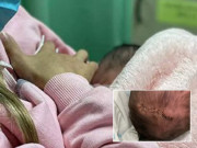 Bà bầu - Đang đi bộ sang phòng đẻ, mẹ bầu giật mình thấy con rơi ra, nhìn em bé mà xót xa