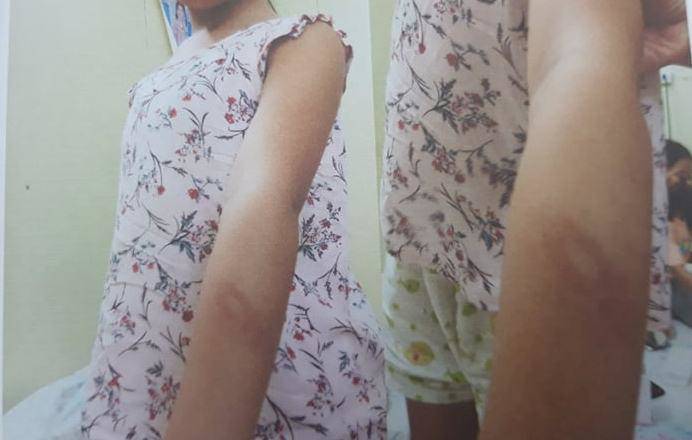 Suspect of two girls being abused by stepfather in Hanoi - 4