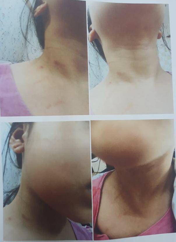 Suspect of two girls being abused by stepfather in Hanoi - 1