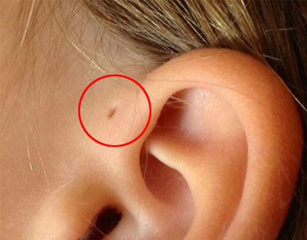 Child hospitalized because mother often massage amp;#34;smart holeamp;#34;  This is in the ear, 3 positions parents should not arbitrarily touch - 3