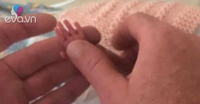 Premature baby weighs only 5 kg, his hand is as small as his father’s finger, the picture after 1 year is surprising
