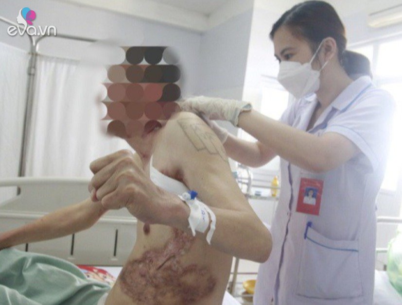 Quang Ninh man has sores and scars all over his body because of rare pus secretion from sweat