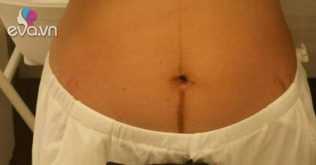 Pregnant women often have a brown stripe in the middle of the abdomen, what does it mean?