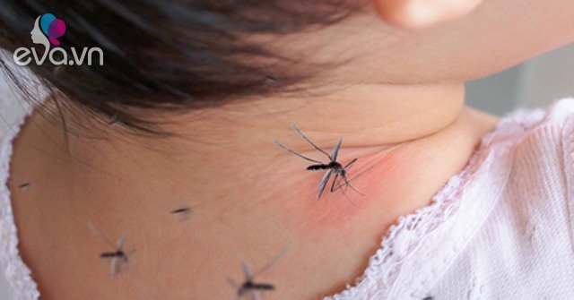 Manifestations of severe dengue fever in children