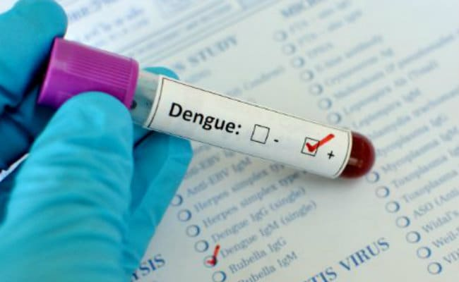 What are the symptoms of a child with dengue fever?  - first