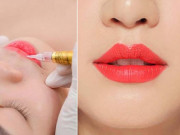 Phun xăm môi và những điều cần lưu ý để tránh tiền mất, tật mang