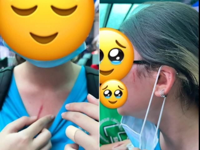 Phụ huynh tố con gái bị bạn học bạo hành ngay trong khuôn viên trường quốc tế xôn xao MXH