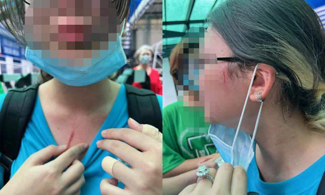 Vụ phụ huynh tố con bị bạn đánh ở trường quốc tế: Hiệu trưởng nhà trường lên tiếng - 2