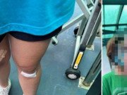 Tin tức - Vụ phụ huynh tố con bị bạn đánh: Trường Quốc tế TP.HCM nhận "một phần trách nhiệm"