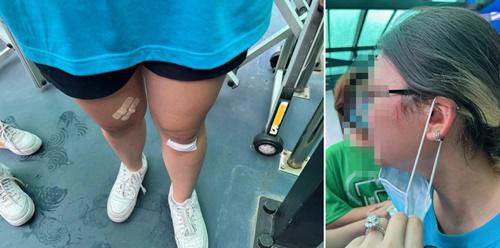 Một số học sinh bị thương sau vụ xô xát. (Ảnh: Zing)