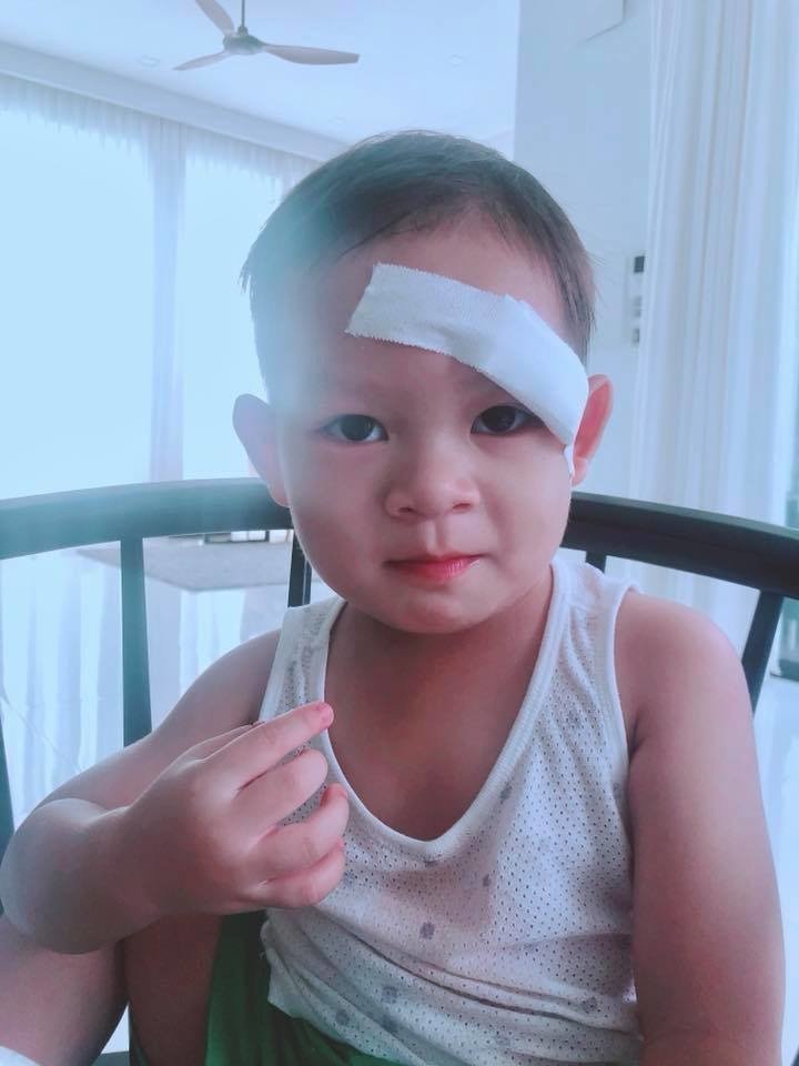 Ho Ngoc Ha felt sorry for her daughter when she fell on her face and scratched her face - 12