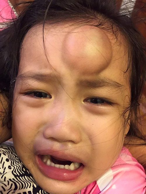Ho Ngoc Ha felt sorry for her daughter when she fell on her face and scratched her face - 8